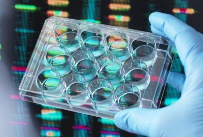 Image of a person with a gloved hand holding a petri dish.